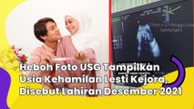 Heboh Foto USG Tampilkan Usia Kehamilan Lesti Kejora, Disebut Lahiran Desember 2021