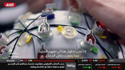 ...مائي للخلايا العصبية في القشرة الدماغية ...