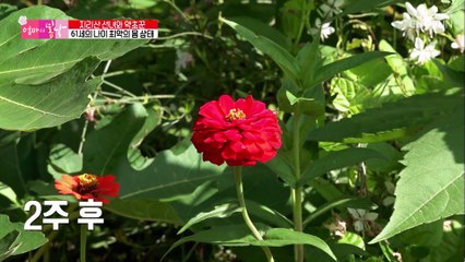 나이에 비해 심각한 수준의 관절염가진 엄마의 변화↗ TV CHOSUN 20211003 방송