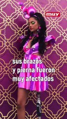La historia de Victoria Salcedo, la candidata a Miss Ecuador que perdió sus brazos y una pierna