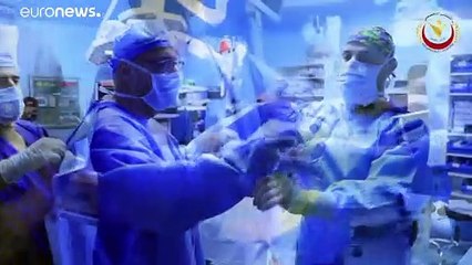 فريق طبي أردني ينجح في فصل توأمين يمنيين في عملية "نادرة"