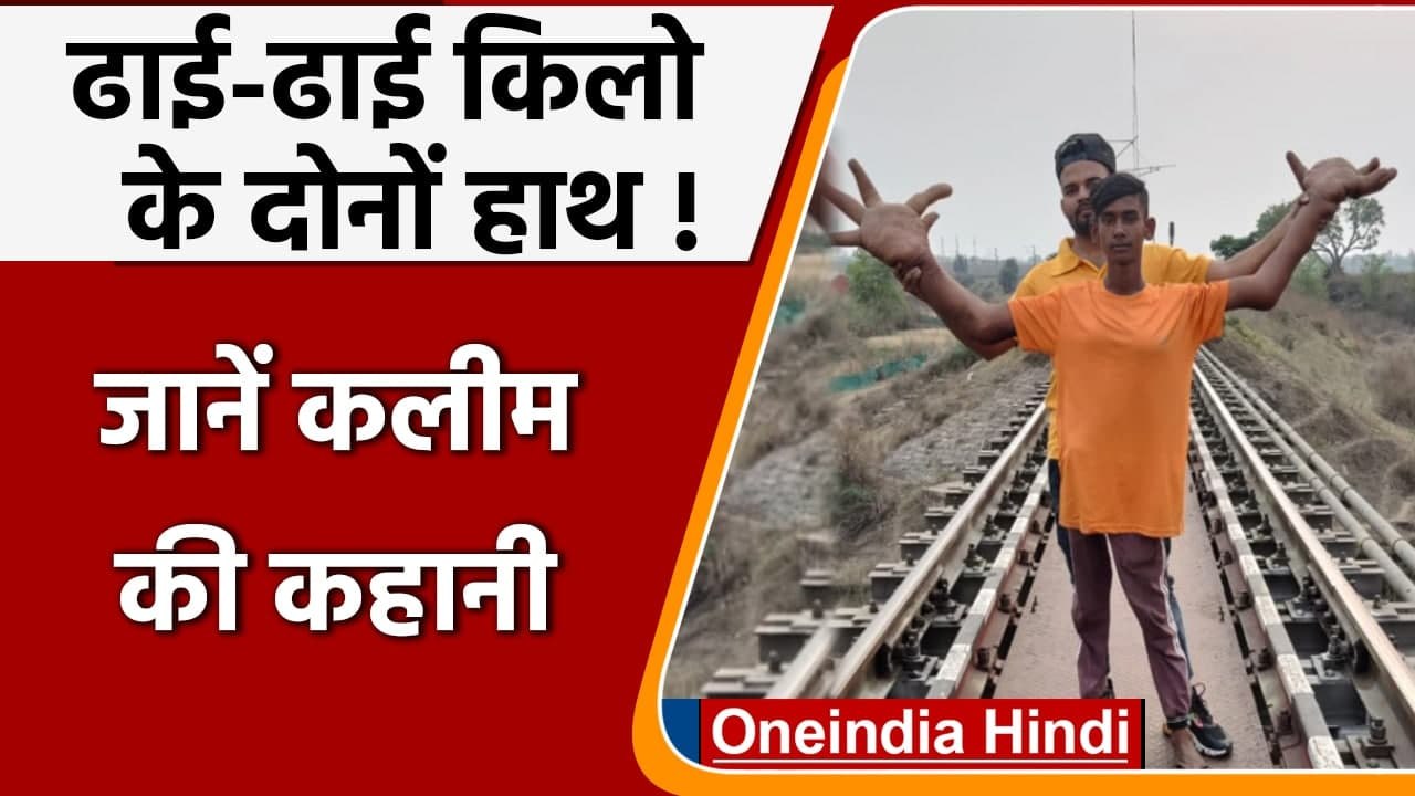 Jharkhand: Moh. Kalim के ढाई-ढाई किलो के हाथ,लोग कहते है 'Devil's Child'|वनइंडिया हिंदी