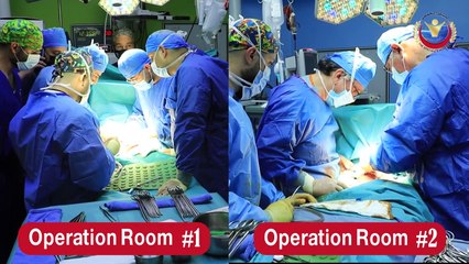 فريق طبي أردني نجح في فصل توأمين سياميين يمنيين