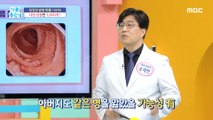 [HEALTHY]100% chance of developing familial adenomatous polyps and colorectal cancer?,기분 좋은 날 211005