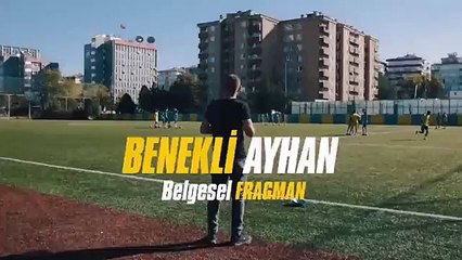 Fenomen 'Benekli Ayhan': Türk milleti hiçbir vasfı olmayan insanların ünlü diye g*tlerini kaldırıyor, biri de benim