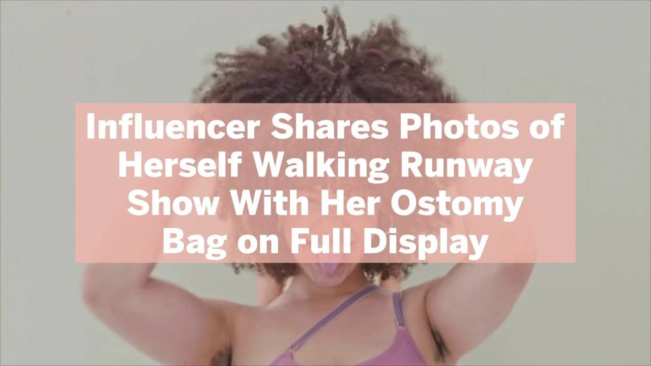 Influencer Shares Photos of Herself Walking Runway Show With Her Ostomy Bag on Full Display
