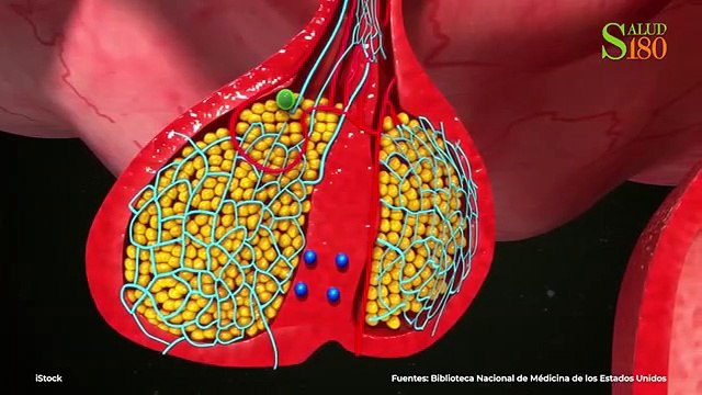 Señales de cortisol alto y remedios naturales para bajarlo| Salud180