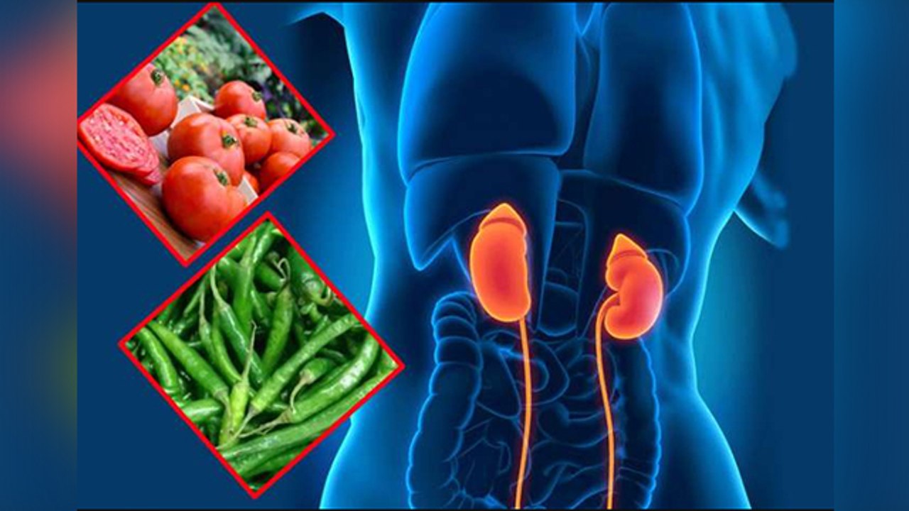 Kidney Stone होने पर क्या खाना चाहिए क्या नहीं ? Kidney Stone Par Kya khaye Kya Nahi । Boldsky