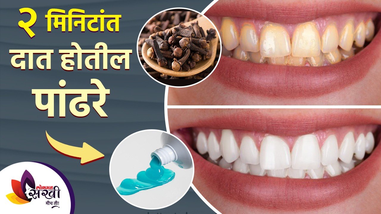 पिवळे दात चमकदार बनवायचे आहेत? तर करा 'हे' घरगुती उपाय | How to Get Rid of Yellow Teeth at Home