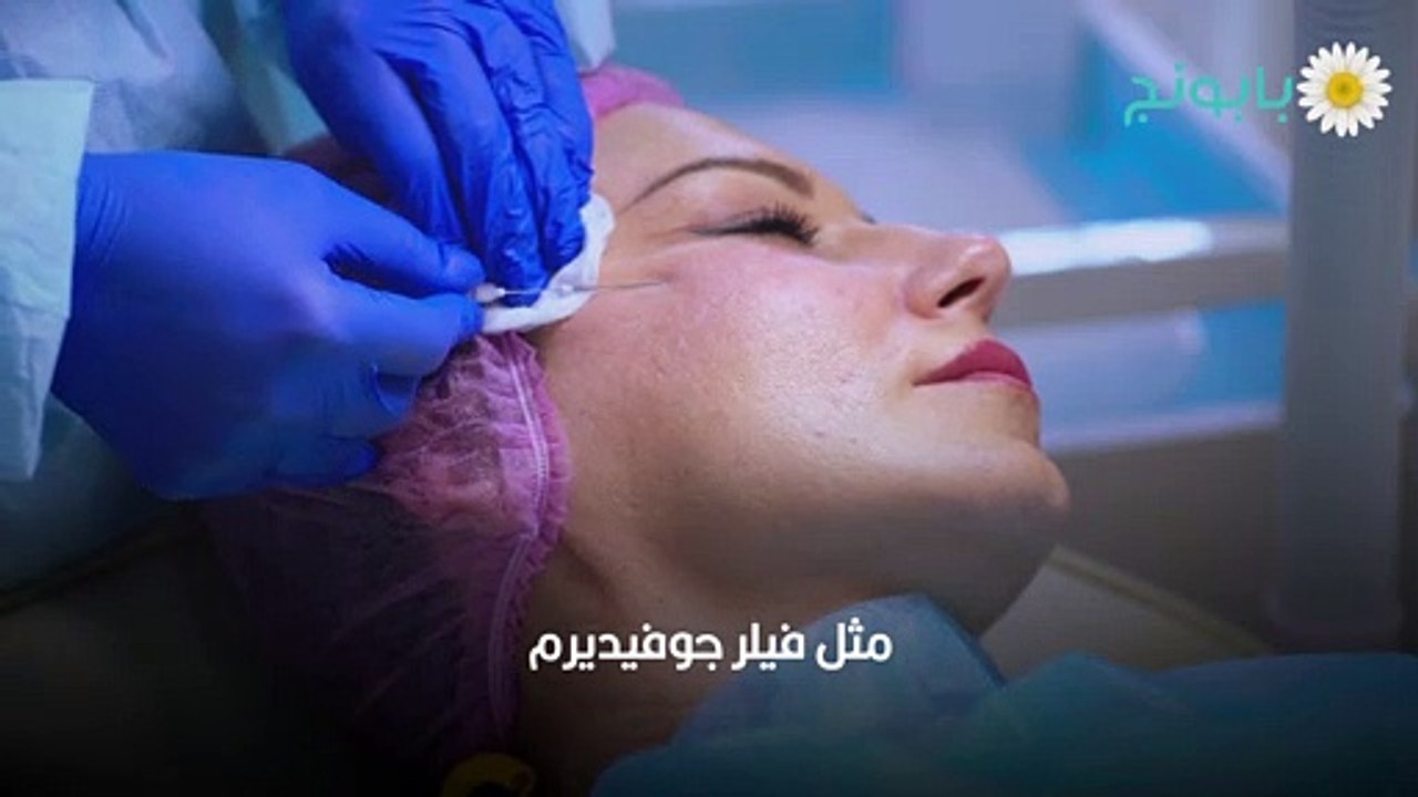 تذويب الفيلر