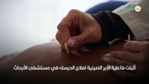 الإبر الصينية لعلاج الديسك