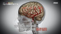 [INCIDENT] If your blood vessels get worse, you'll get dementia?, 생방송 오늘 아침 211008