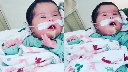 '1.5 Weeks Old baby with down syndrome interacts with family members via video'
