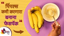 पिंपल्स कमी करणारा केळ्याचे फेसपॅक | Banana Face Pack for Pimples | Lokmat Sakhi