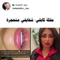 ملكة كابلي تظهر بشفاه متحجرة