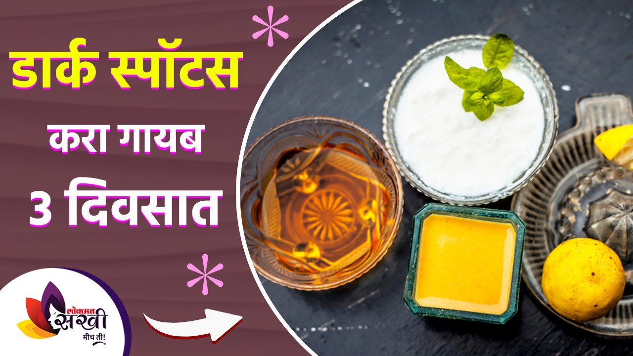 चेहऱ्यावरील काळे डाग होतील ३ दिवसात गायब | How to Get Rid of Dark Spots | Lokmat Sakhi