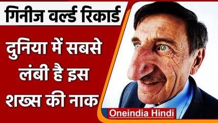 World Biggest Nose: 71 की उम्र में भी बढ़ रहा साइज, गिनीज बुक में दर्ज है रिकॉर्ड | वनइंडिया हिंदी