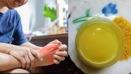 Uric Acid की Problem से जूझ रहे लोगों को दाल खानी चाहिए या नहीं । Boldsky