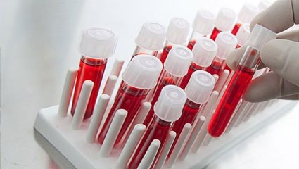 0 kan grubunda olanlar yaşadı! Tansiyon ve kansere daha az yakalanıyorlar