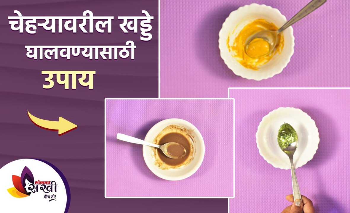 चेहऱ्यावरील खड्डे घालवण्यासाठी सोपे घरगुती उपाय | Home Remedies for ACNE SCARS | Lokmat Sakhi