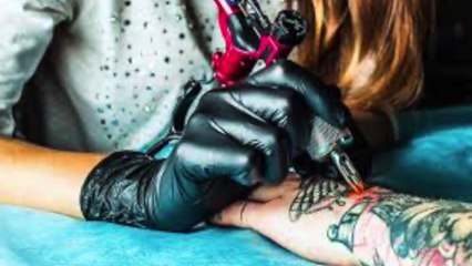 rimozione tatuaggi