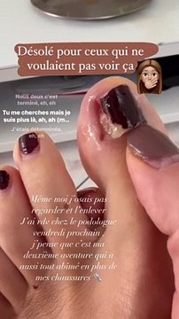 Alexandra, aventurière phare de Koh-Lanta , partage une vidéo de son ongle qui se décolle, sur Instagram.