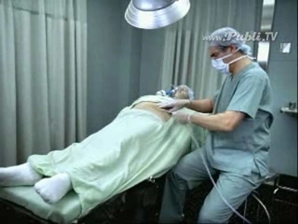 Liposuccion nouvelle technique
