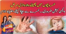 Measles: Symptoms, Diagnosis, and Treatments ... watch video