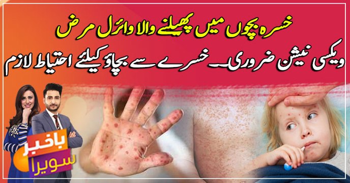 Measles: Symptoms, Diagnosis, and Treatments ... watch video