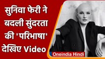 Alopecia Universalis की शिकार Sunniva Ferri, महिलाओं के लिए बनीं प्रेरणा | वनइंडिया हिंदी