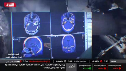 ...الانظمة تعقيدا التي نتعامل معها في البحو...