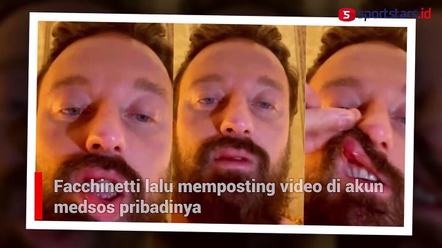 Bikin Ulah Lagi, Conor McGregor Bogem DJ Italia Hingga Bibir Sobek