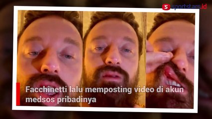 Bikin Ulah Lagi, Conor McGregor Bogem DJ Italia Hingga Bibir Sobek