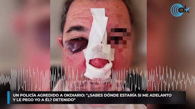 Un policía agredido a OKDIARIO: ¿Sabes dónde estaría si me adelanto y le pego yo a él? Detenido