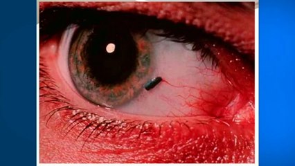 bd-tratar-emercencias-oculares-para-evitar-riesgos-191021