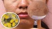 Face पर Dark Patches का Aloe Vera Gel से रामबाण इलाज WATCH VIDEO | Boldsky