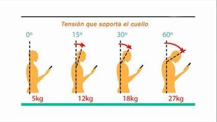 bd-causas-y-tratamientos-para-el-dolor-de-cuello-201021