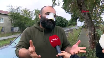 Tasmasız pitbull iş insanının burnunu kopardı