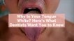 Why Is Your Tongue White? Here's What Dentists Want You to Know
