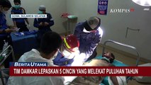 5 Cincin Melekat Puluhan Tahun di Jari Pria Gangguan Jiwa