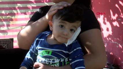 ANTALYA'DA PİTBULL DEHŞETİ; BEBEĞİN YANAĞINI KOPARDI, BABANIN KOLU VE BACAĞINI ISIRDI