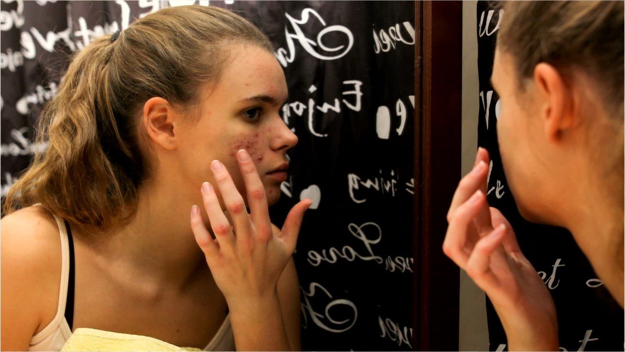 8 Signs that your skincare is damaging your skin