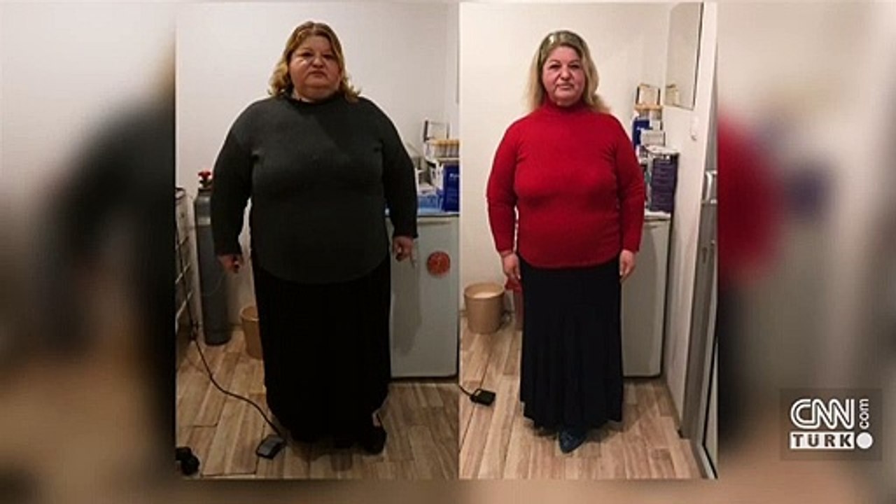 Diyet yapmadan zayıflamak mümkün mü?