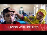 Kashmir’s Pellet Victims Welfare Trust is trying to help victims