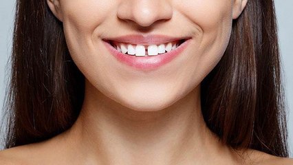 दांतों में है गैप होना लकी नही है खतरनाक, जबड़ा चैक कराएं । Boldsky