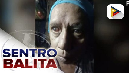 MALASAKIT AT WORK: Isang lalaki sa Malabon, humihingi ng tulong para mapaoperahan ang kanyang mata