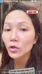 H'Hen Niê gây hoang mang khi khuôn mặt xuất hiện nhiều vết bầm tím