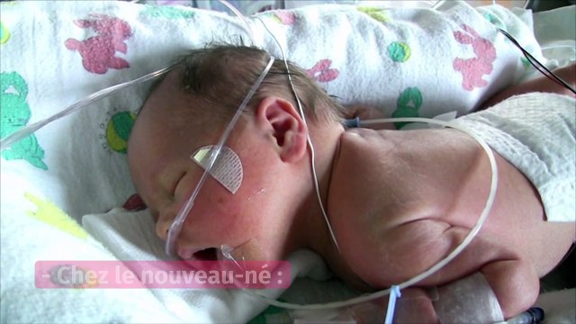 Grossesse : le café est-il dangereux quand on est enceinte ?