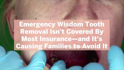 Emergency Wisdom Tooth Removal Isn't Covered By Most Insurance—and It's Causing Families to Avoid It