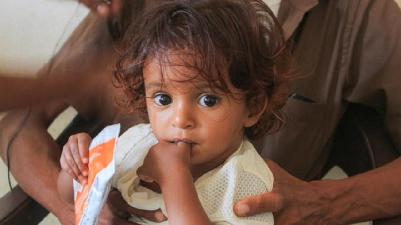 Yemen is facing the world's worst humanitarian crisis, and it's children who are suffering